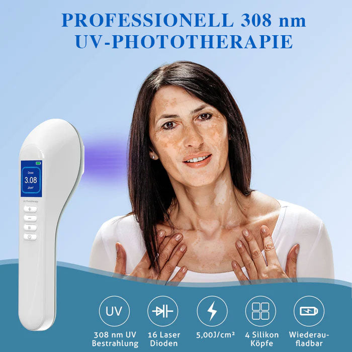 KTS Handheld-UVB-Lichttherapiegerät für Vitiligo/Psoriasis