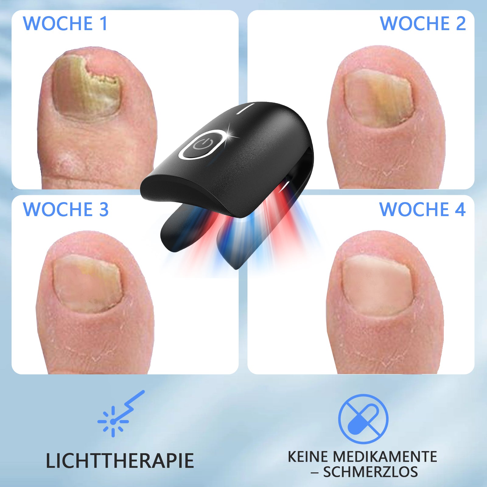 KTS® Nagelpilz-Reinigungsgerät bei Onychomykose