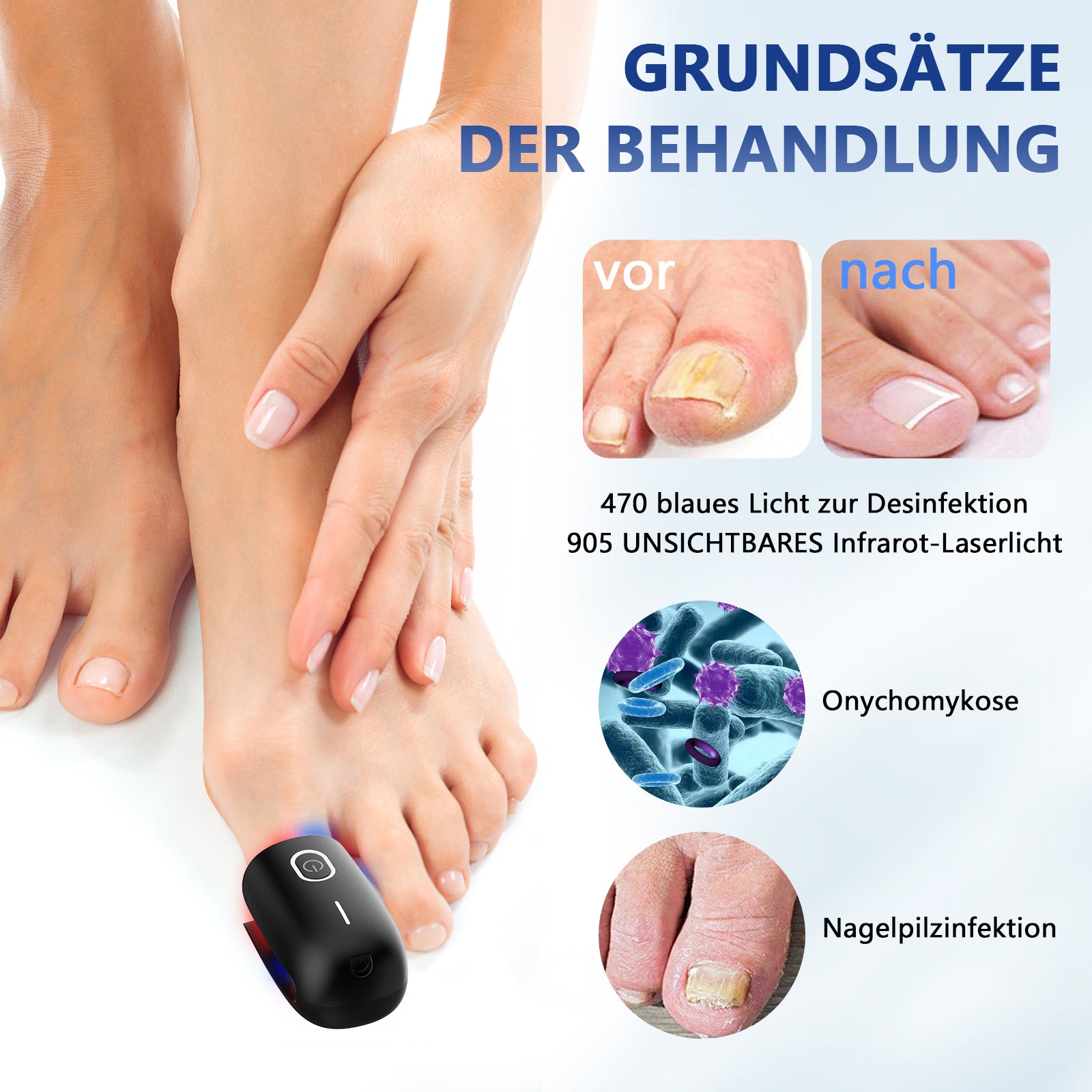 KTS® Nagelpilz-Reinigungsgerät bei Onychomykose