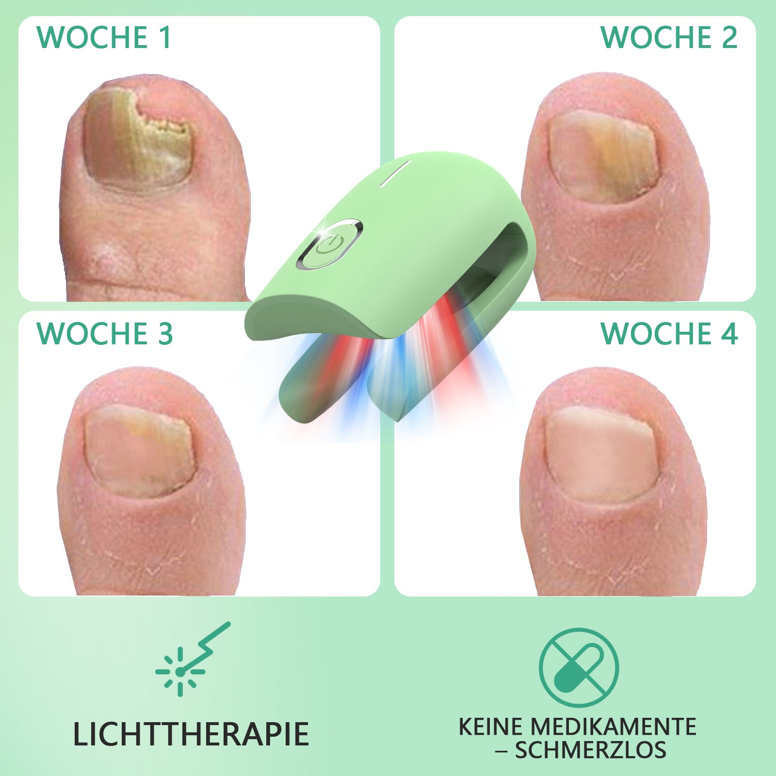 KTS® Nagelpilz-Reinigungsgerät bei Onychomykose