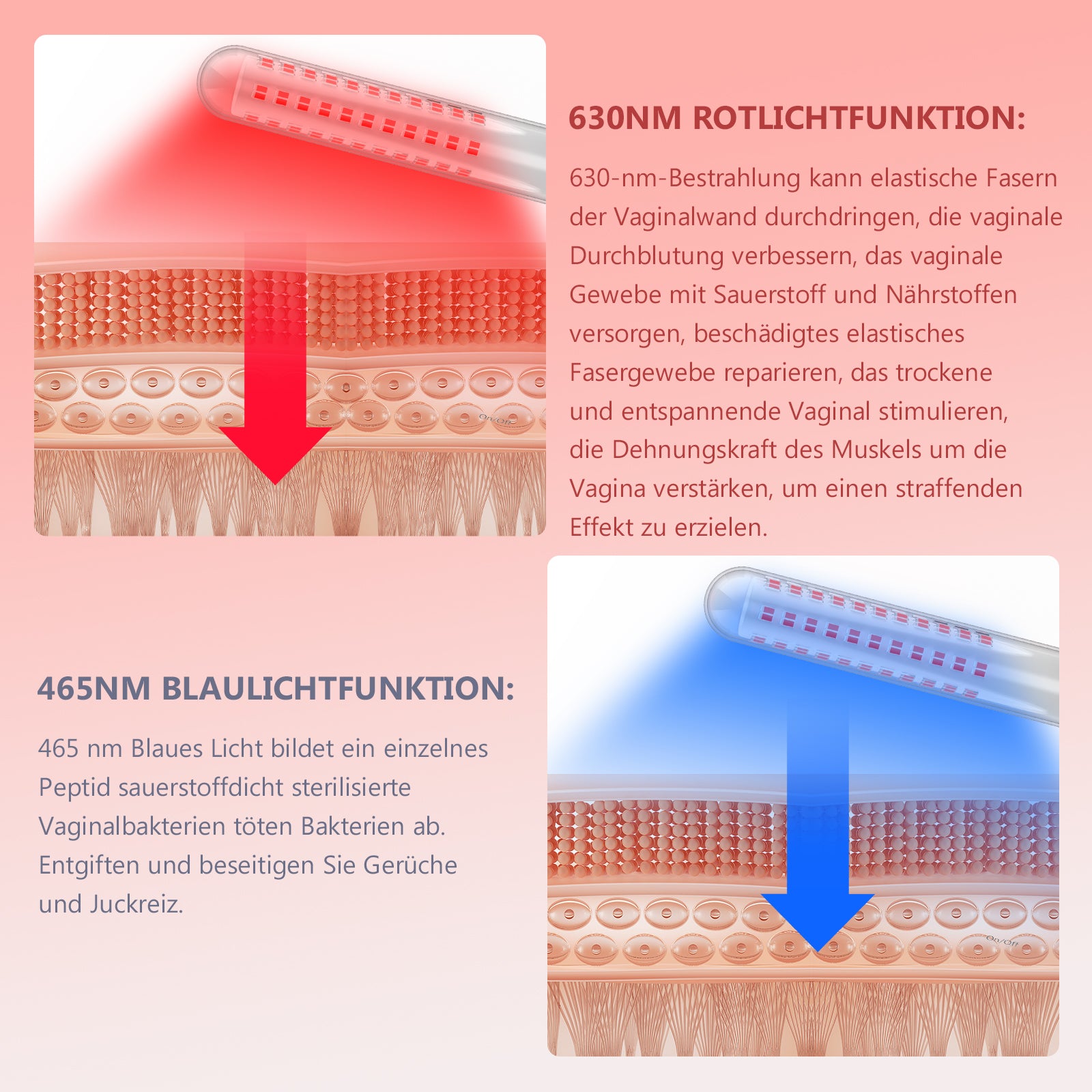 KTS® Gynäkologisches Behandlungsinstrument