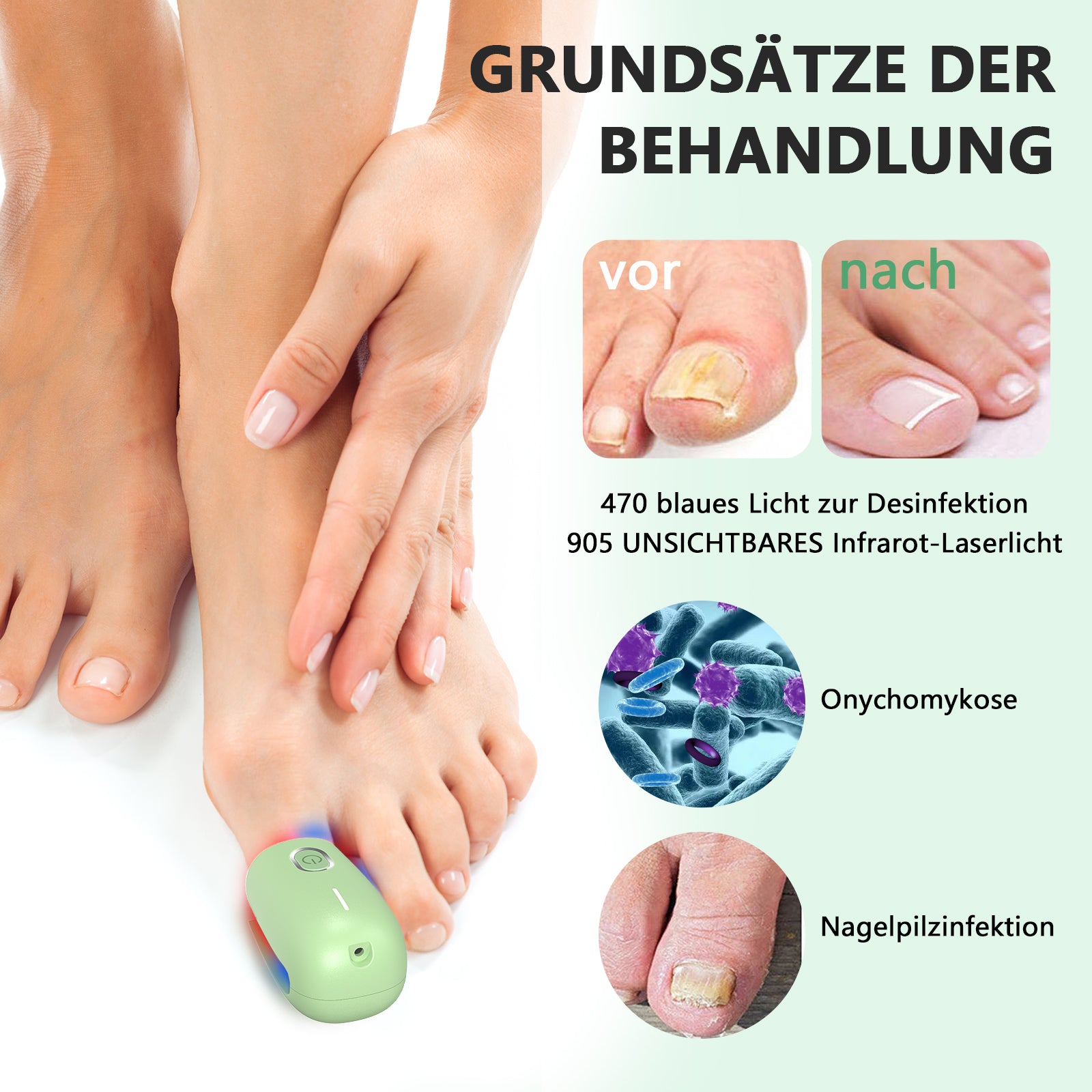 KTS® Nagelpilz-Reinigungsgerät bei Onychomykose