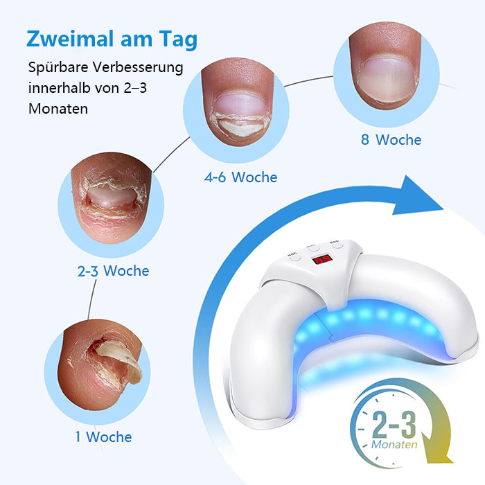 Nagelpilz-Licht für mehrere Zehennägel