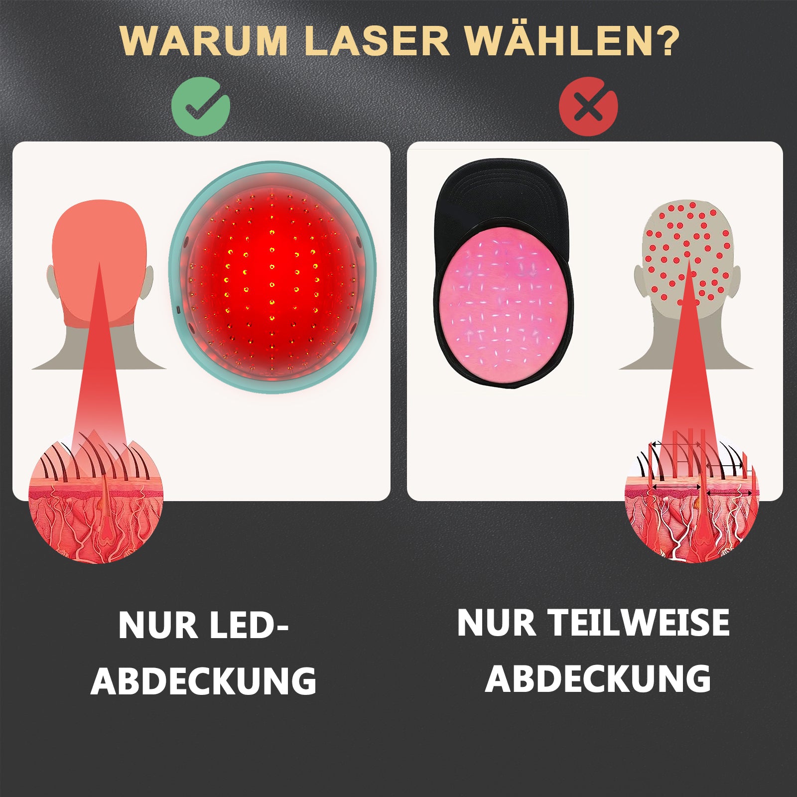 KTS® Haarwuchsbehandlungen Laserkappe