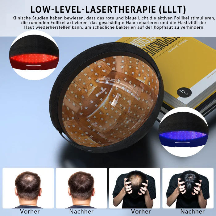 KTS® Laser-Haarwuchskappe: Für dichteres und gesünderes Haarwachstum