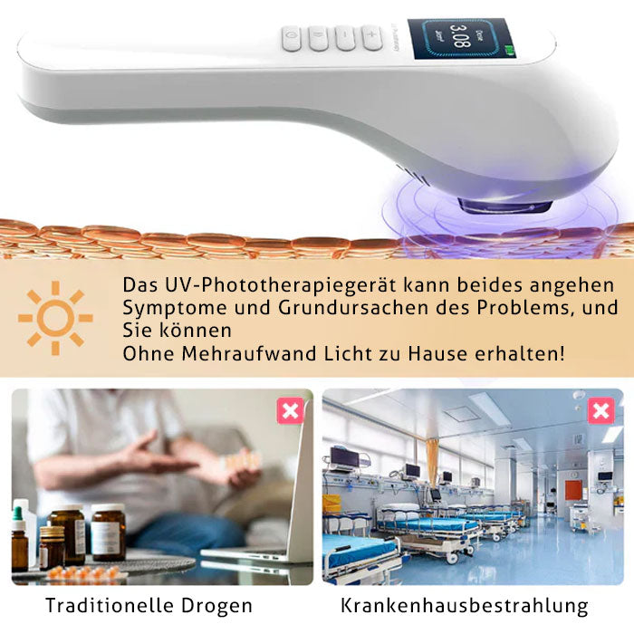 KTS Handheld-UVB-Lichttherapiegerät für Vitiligo/Psoriasis