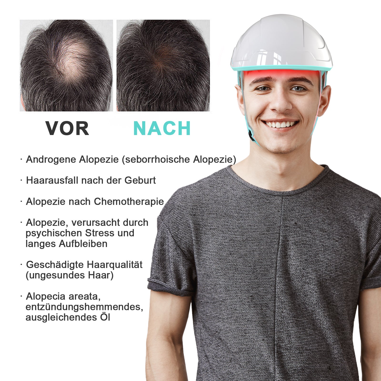 KTS® Haarwuchsbehandlungen Laserkappe