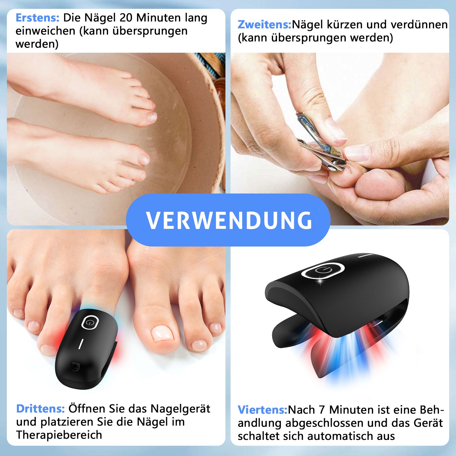 KTS® Nagelpilz-Reinigungsgerät bei Onychomykose