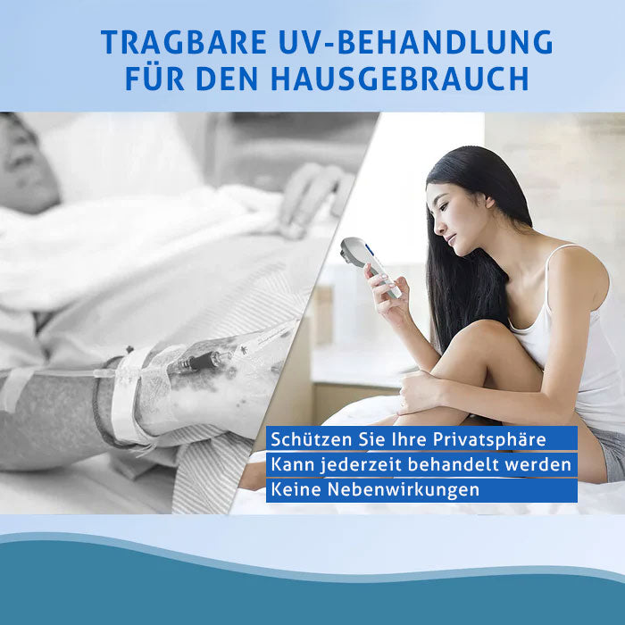 KTS Handheld-UVB-Lichttherapiegerät für Vitiligo/Psoriasis