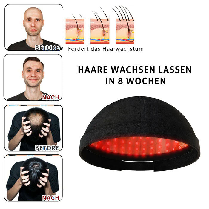 KTS® Laser-Haarwuchskappe: Für dichteres und gesünderes Haarwachstum