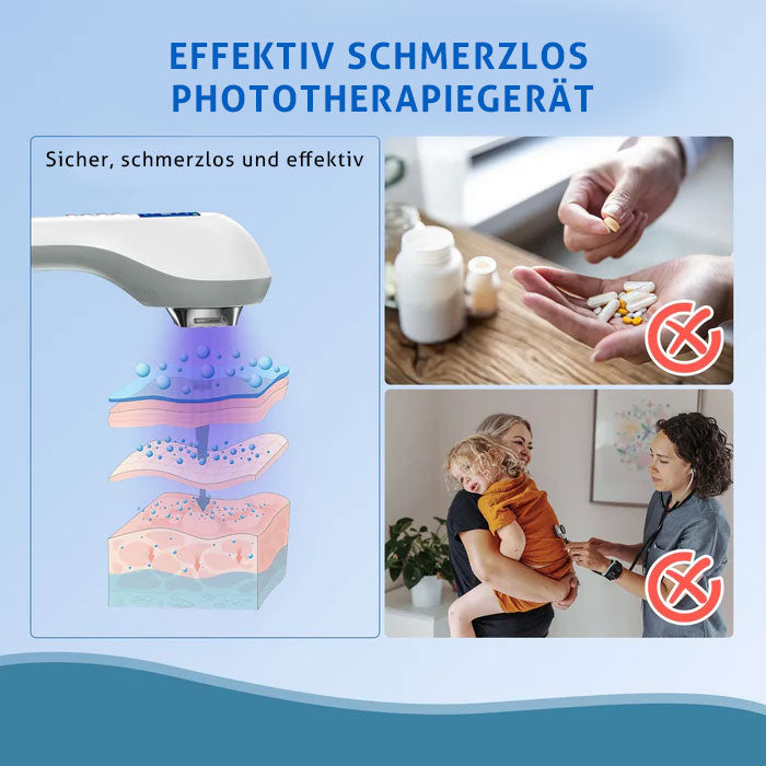 KTS Handheld-UVB-Lichttherapiegerät für Vitiligo/Psoriasis