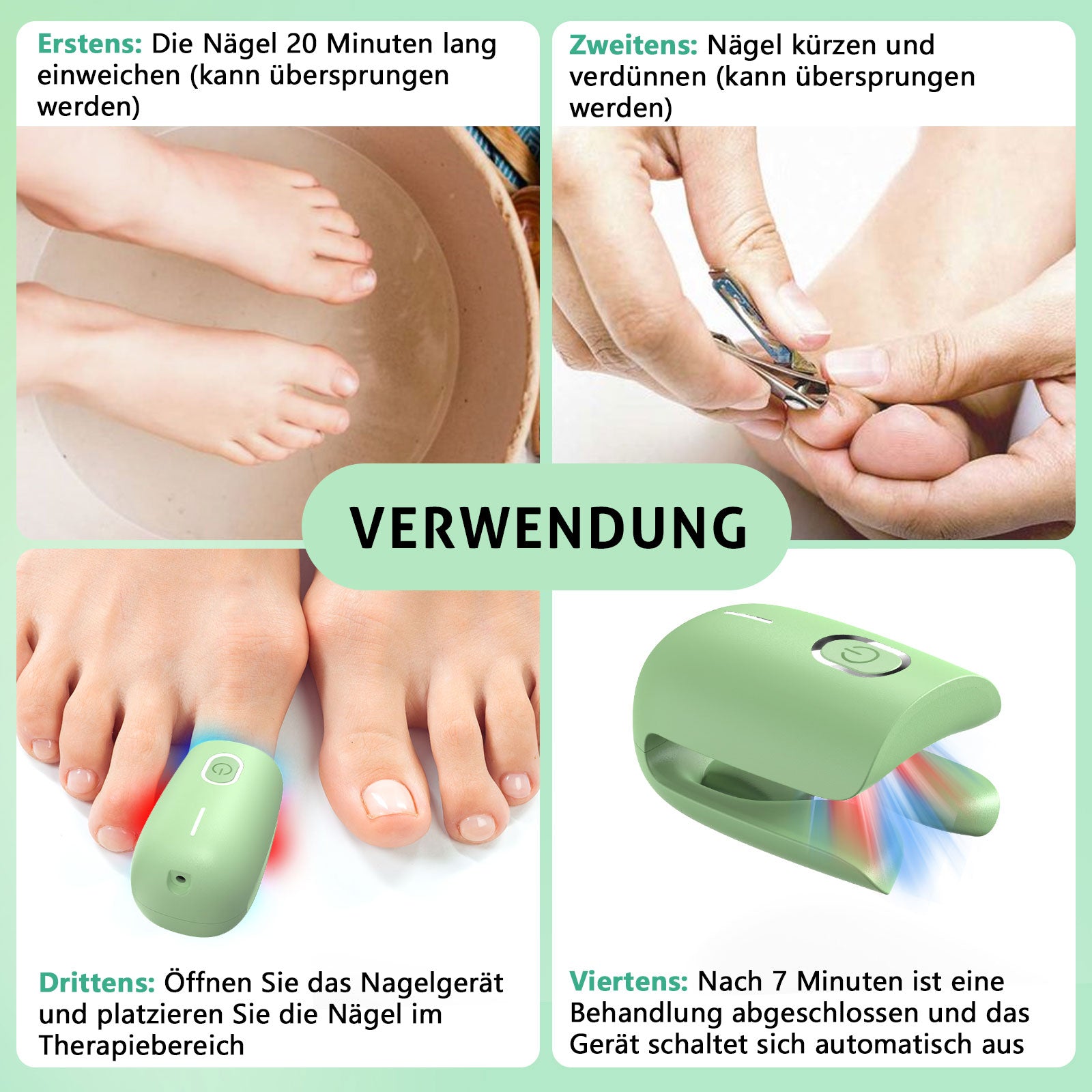 KTS® Nagelpilz-Reinigungsgerät bei Onychomykose