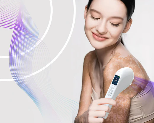 Vitiligo mit Rotlichttherapie bekämpfen