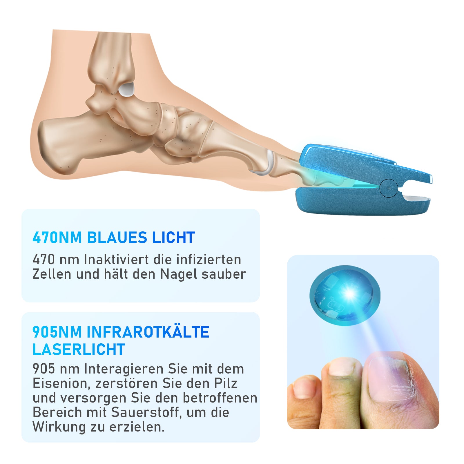 KTS® Nagelpilz Behandlungs Gerät