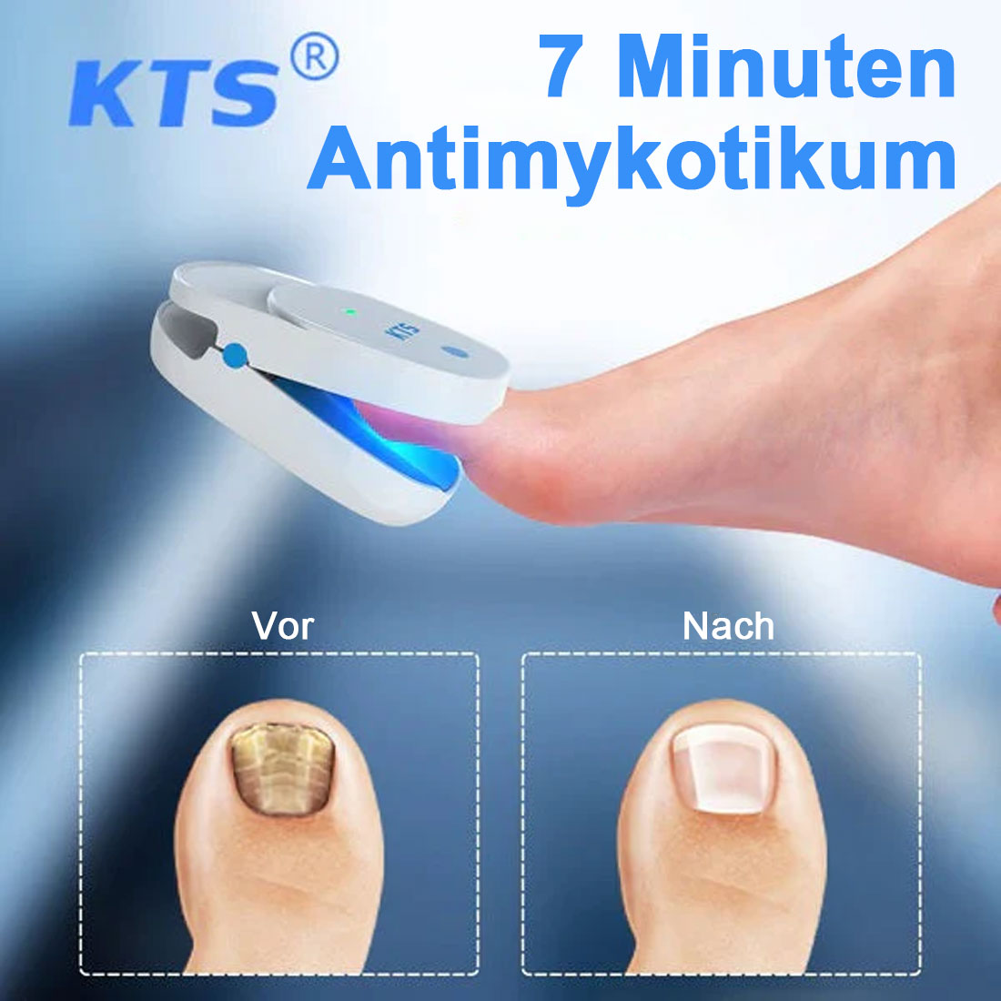 KTS® Nagelpilz Behandlungs Gerät