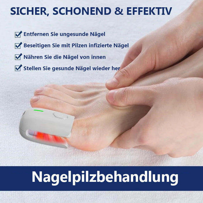 Schnelle Ergebnisse! KTS Laser-Lösung für gesunde Nägel