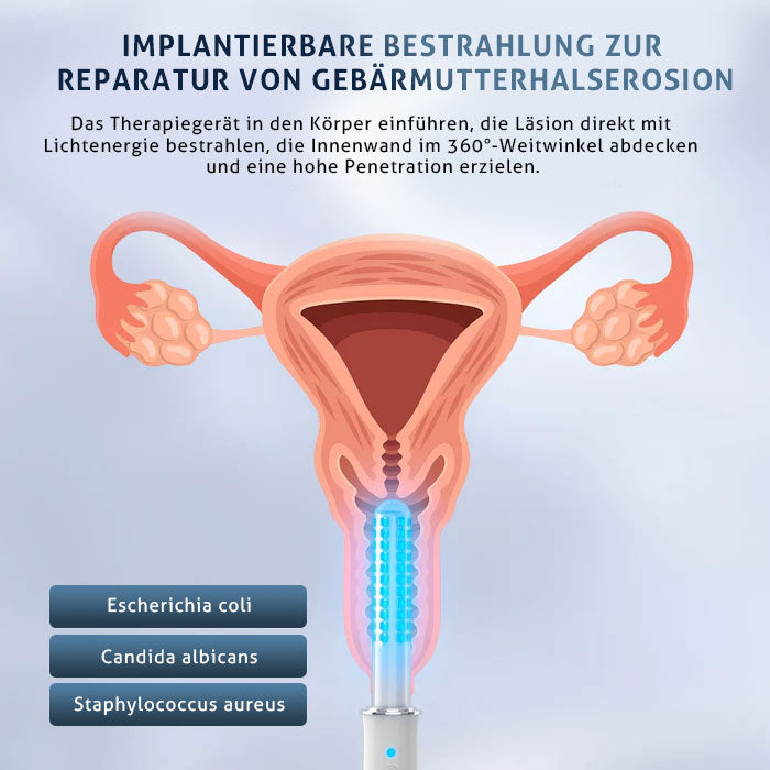 KTS® Tragbarer Vaginalverjüngungsstab