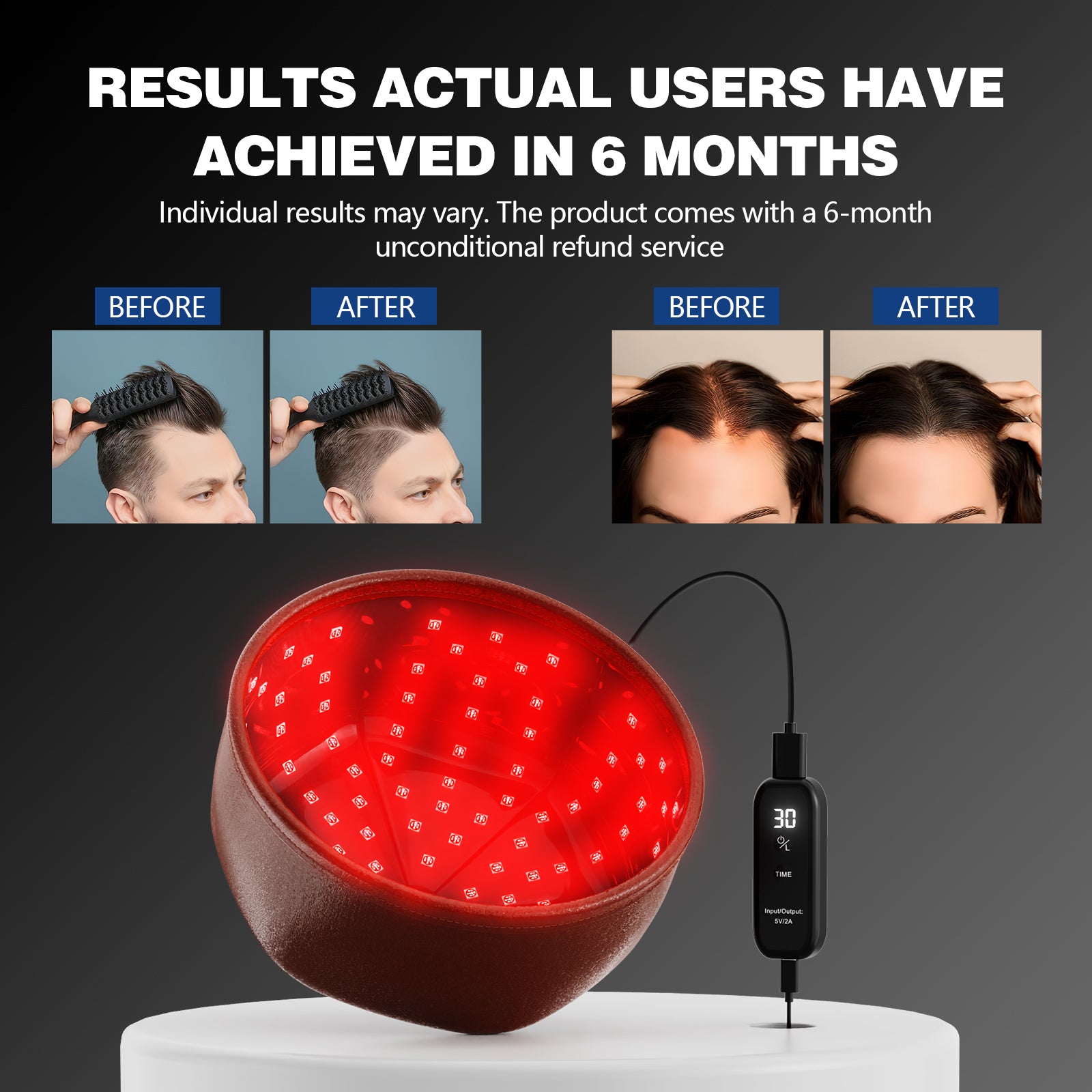 KTS® Laser-Haarwuchskappe 1.0 Pro