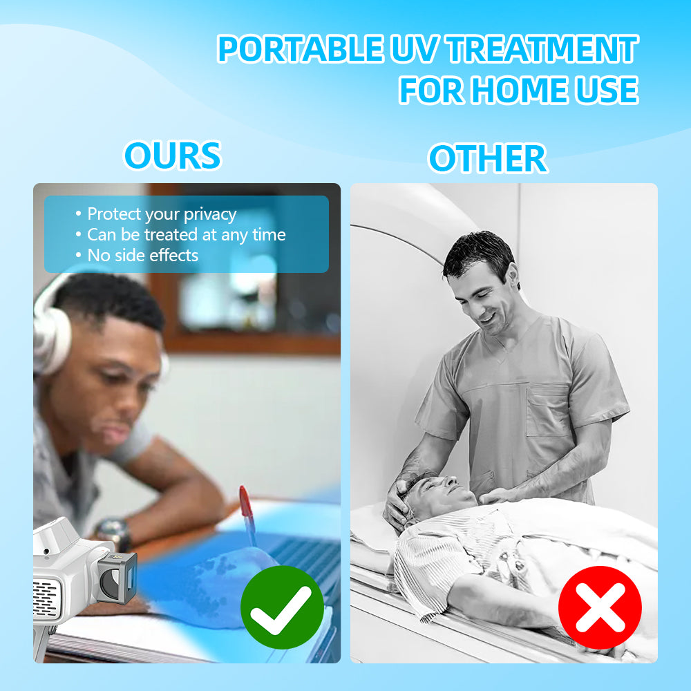 UVB-Vitiligo/Psoriasis-Lichttherapiegerät für zu Hause