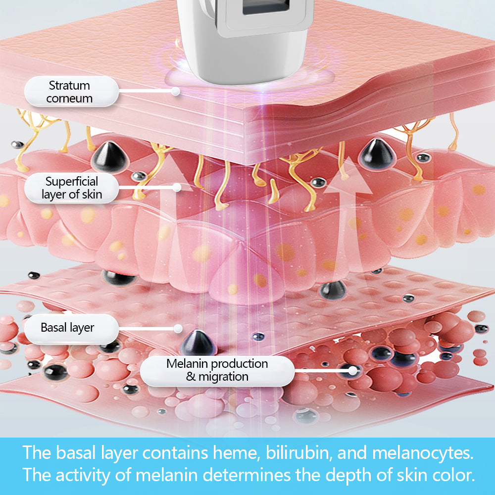 UVB-Vitiligo/Psoriasis-Lichttherapiegerät für zu Hause