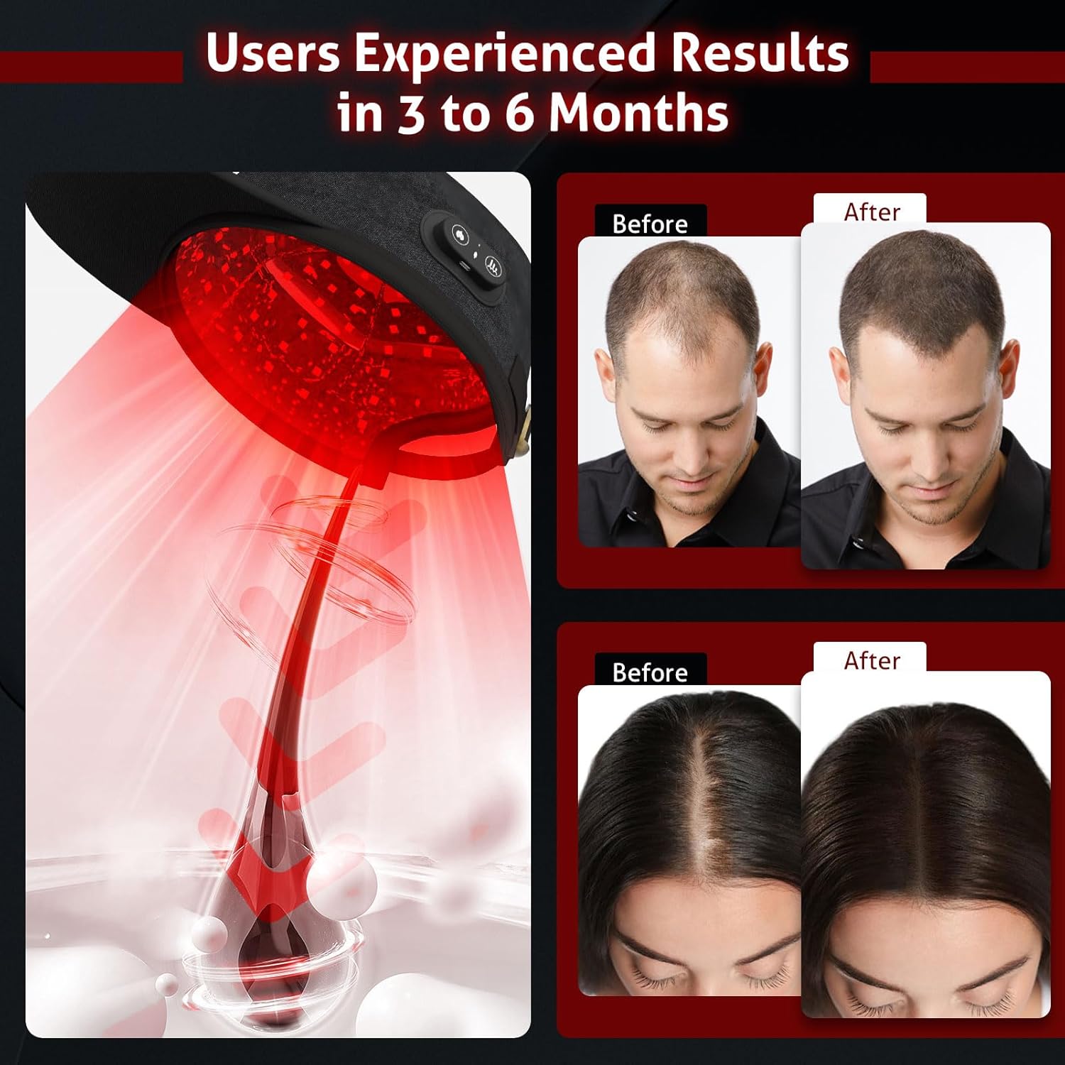 KTS® Kabellose Laserkappe für Haarwachstum